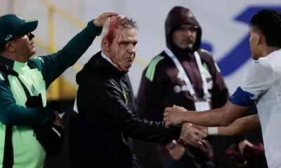 Mexico Coach Aguirre Hit With Beer Can After Honduras Defeat