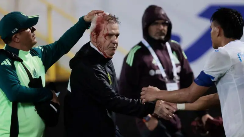 Mexico Coach Aguirre Hit With Beer Can After Honduras Defeat